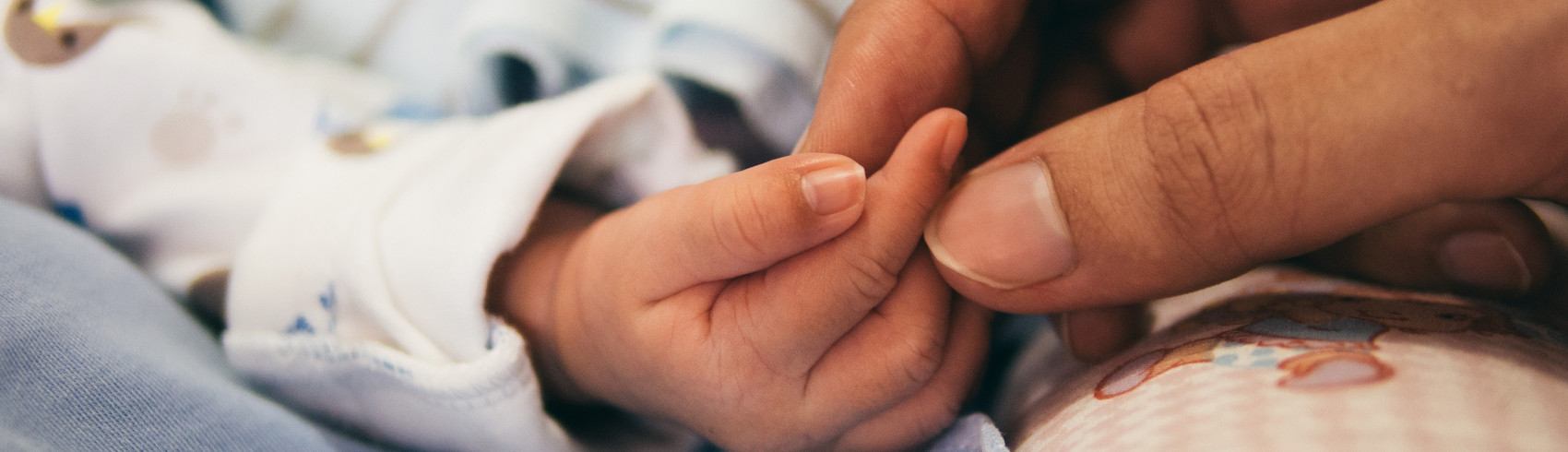 fetal alcohol syndrome hands